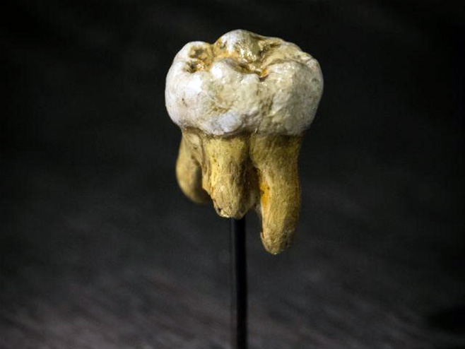 Zub denisovana - 