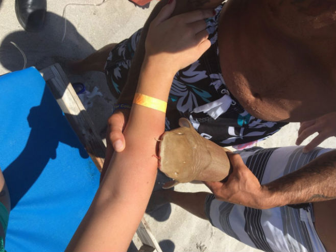 Djevojku ajkula ugrizla za ruku (Foto: Boca Raton Fire rescue) - 