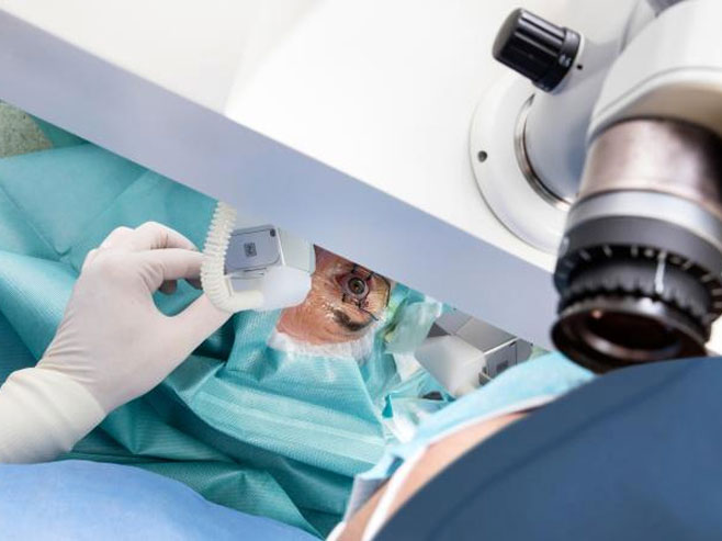 Izvedena prva robotska operacija bolesnog oka - ilustracija (foto:  Thinkstock) - 