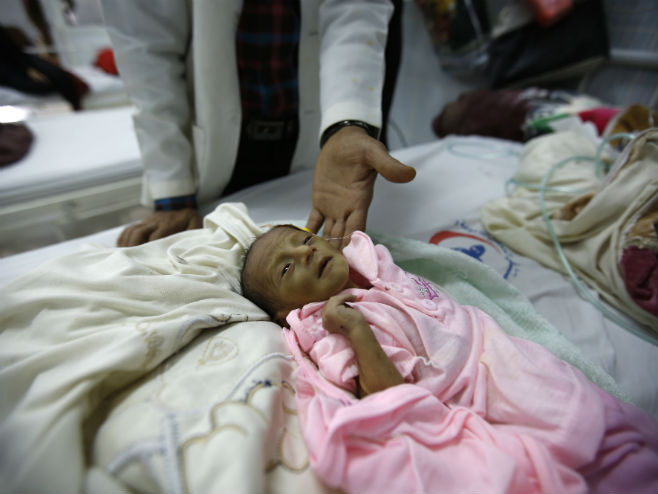 U Јemenu od gladi umiru djeca (Foto: Business Insider) - 