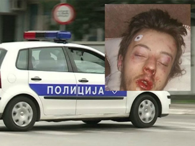 Uhapšena dva lica zbog premlaćivanja mladića iz Teslića - Foto: www.nezavisne.com
