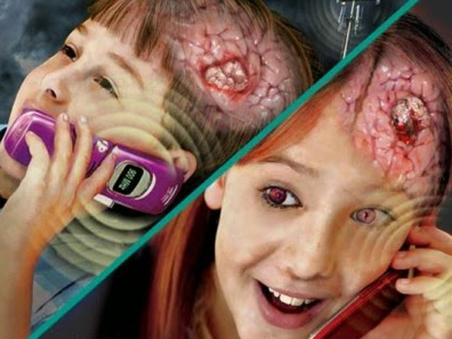 Pretjerana upotreba mobilnih telefona uzrokuje tumor na mozgu? (ilustracija) - 