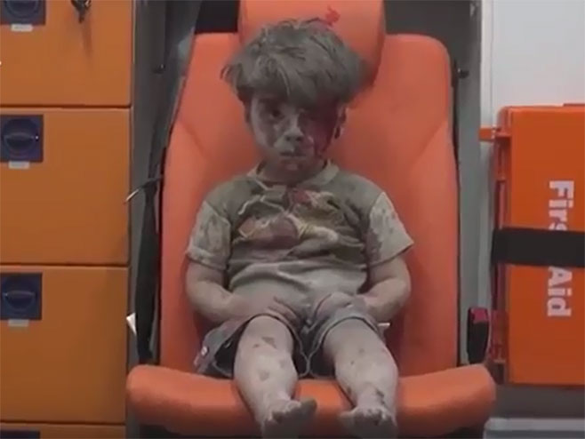 Petogodišnji dječak, koji je izvučen iz ruševina poslije razornih vazdušnih udara na Alepo - Foto: Screenshot/YouTube