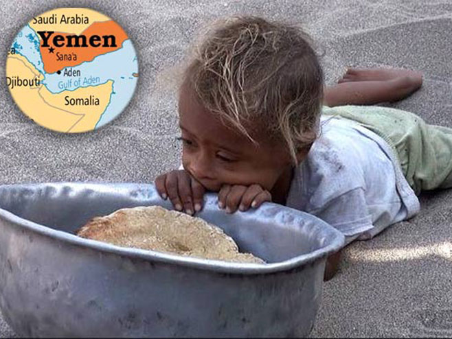 Јemen rat (Foto:Novi Svjetski Poredak) - 