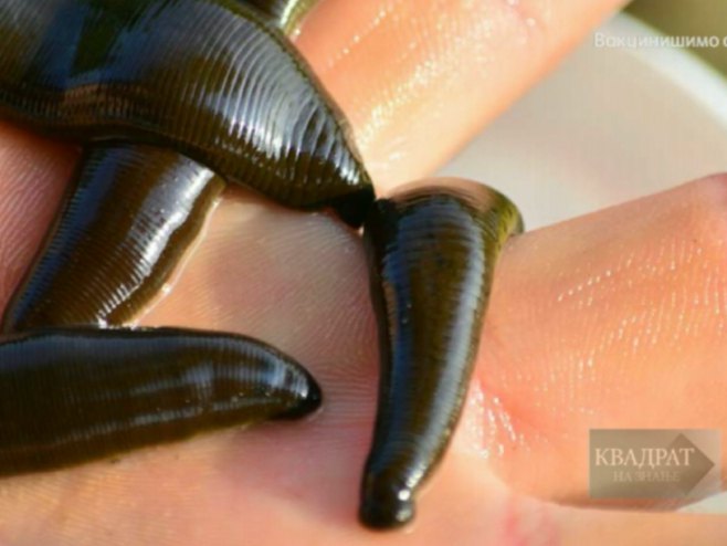 Pijavce Pijavce - Foto: RTRS