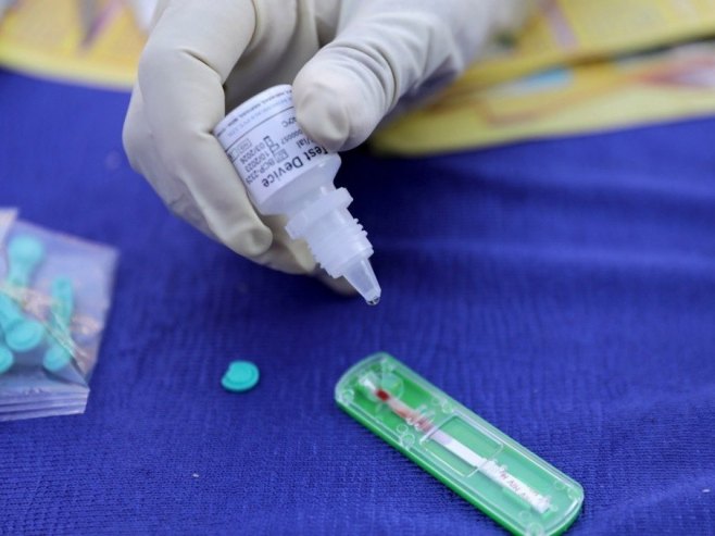 HIV testiranje (foto: EPA-EFE/PIYAL ADHIKARY) - 