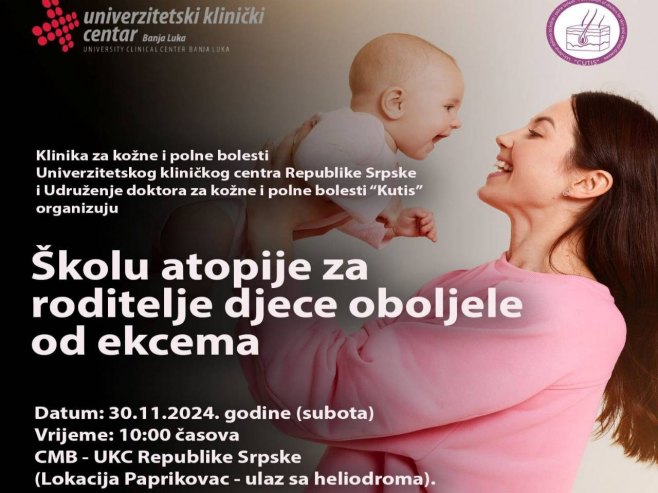 UKC Srpske: U subotu Škola atopije za roditelje djece oboljele od ekcema