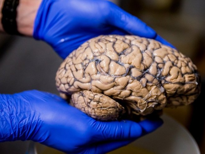 Mozak prolazi kroz pet faza tokom ljudskog života