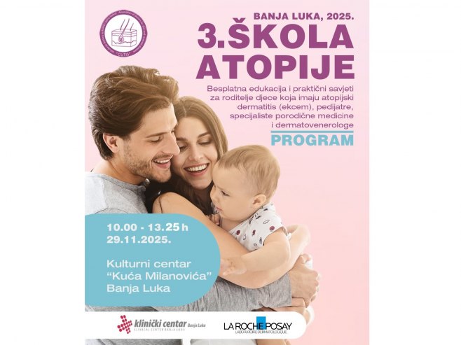 Atopijski dermatitis u dječijoj populaciji 30 odsto; U Banjaluci sutra besplatna edukacija roditelja (VIDEO)
