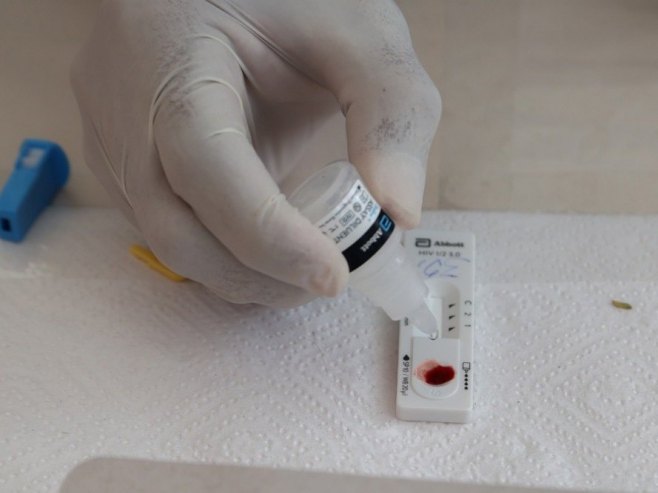Prevencijom do smanjenja broja oboljelih od HIV-a (VIDEO)