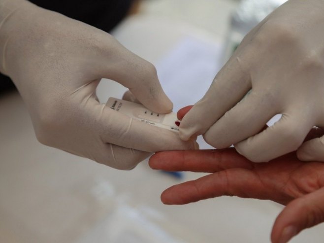 Svjetski dan borbe protiv HIV-a - besplatno testiranje širom Srpske (VIDEO)