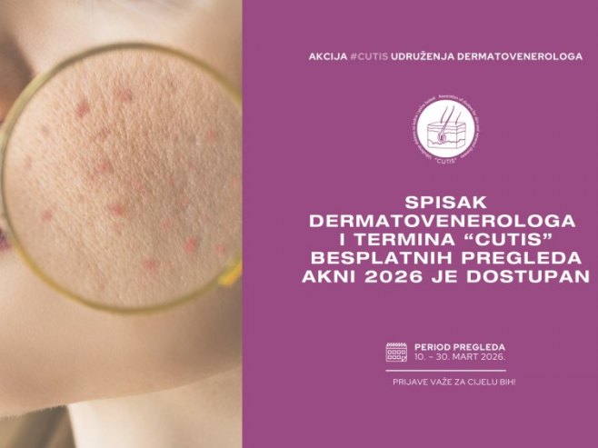 Od danas besplatni dermatološki pregledi akni u Klinici za kožne i polne bolesti UKC Srpske