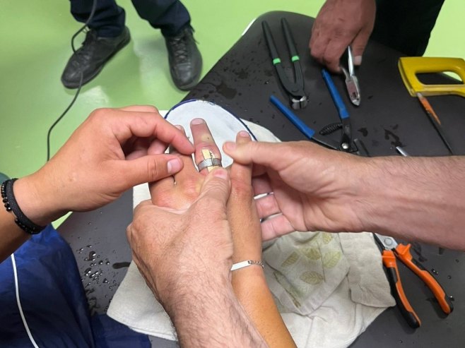 Neobična intervencija: Vatrogasci u Prijedoru skidali prsten s ruke (FOTO)